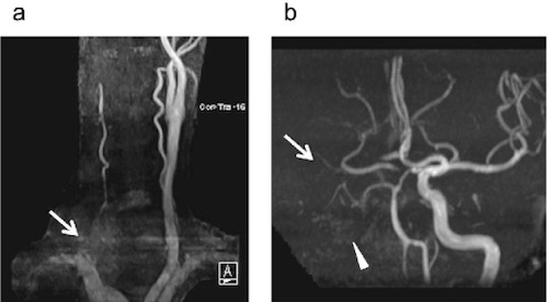 Neck Trauma - The Operative Review Of Surgery