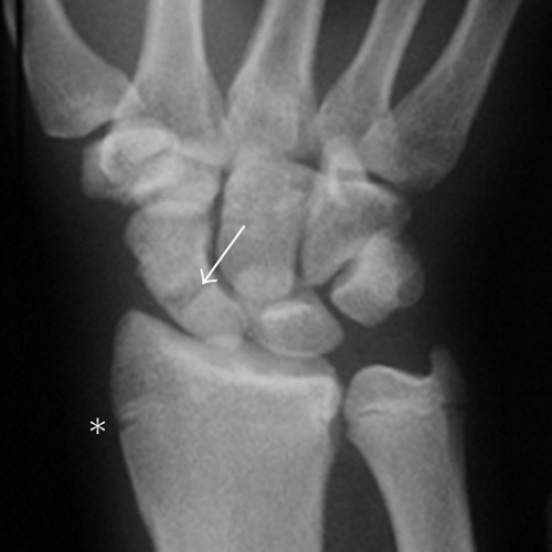 Hand Injury - The Operative Review Of Surgery