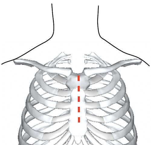 Thoracic Incisions The Operative Review Of Surgery