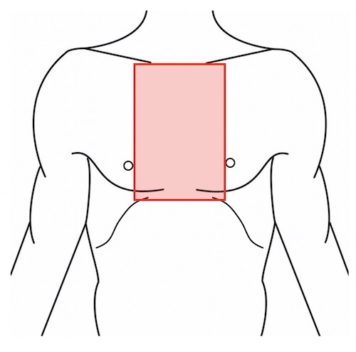 Thoracic Trauma - The Operative Review Of Surgery