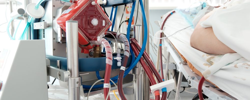 working ecmo machine in intensive care department